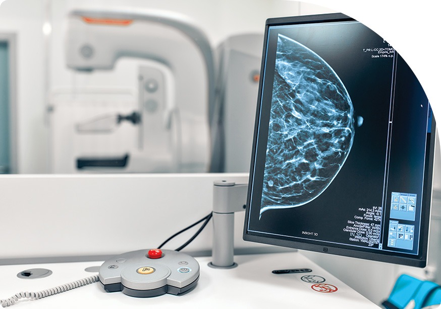 Mammography | Breast Assessment | Saddletown Radiology | NE Calgary | Radiology Clinic