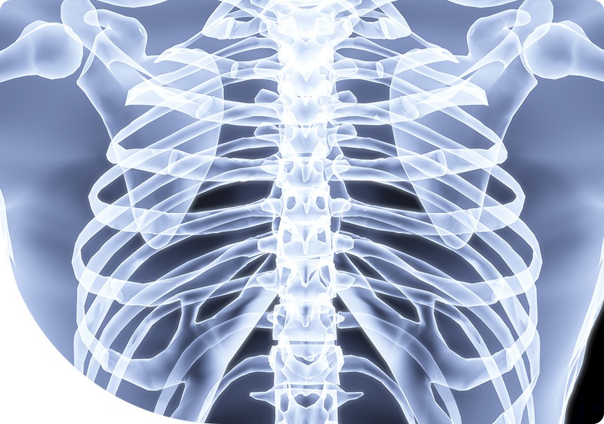 Purpose of X-Ray | Saddletown Radiology | NE Calgary | Radiology Clinic