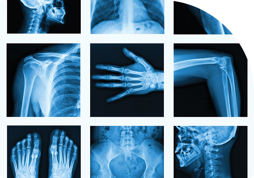 What is an X-Ray | Saddletown Radiology | NE Calgary | Radiology Clinic