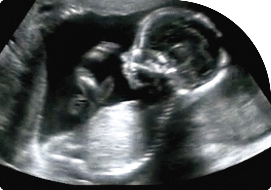 Obstetrics/Pregnancy Ultrasound | Saddletown Radiology | NE Calgary | Radiology Clinic